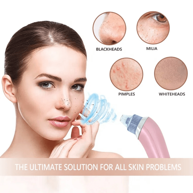 Aspirateur Électrique Anti-Points Noirs – Nettoyeur de Pores Visage et aspirateur de graisses 4