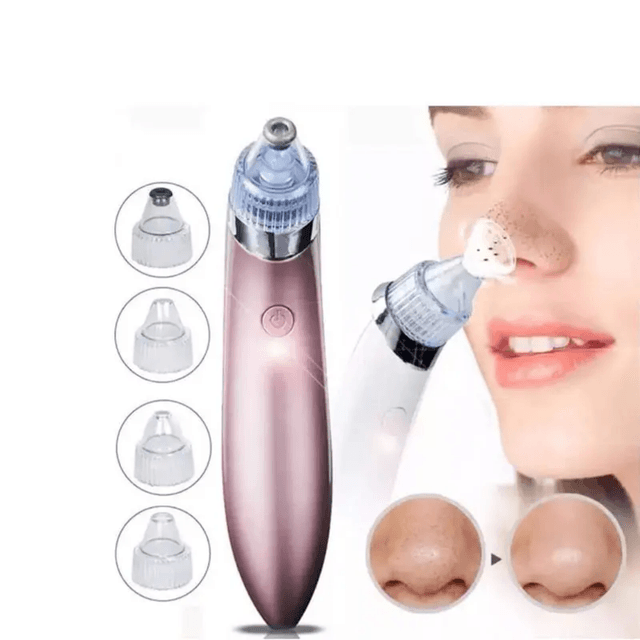 Aspirateur Électrique Anti-Points Noirs – Nettoyeur de Pores Visage et aspirateur de graisses 3