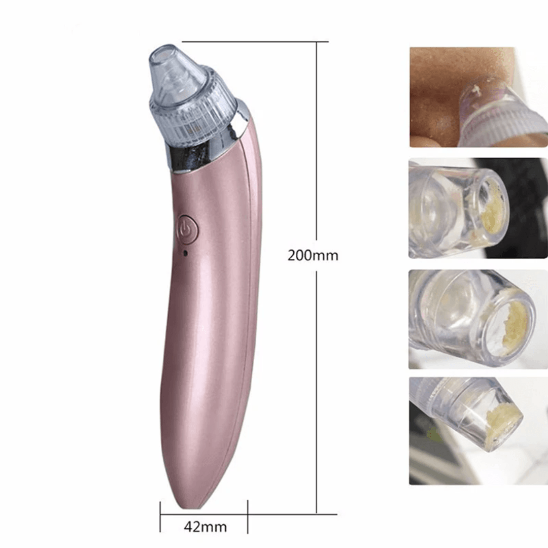 Aspirateur Électrique Anti-Points Noirs – Nettoyeur de Pores Visage et aspirateur de graisses